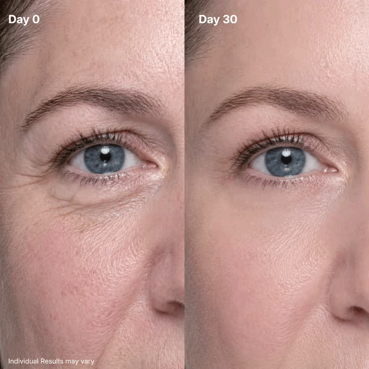 Raznave P7™ Eye Renewal Creme