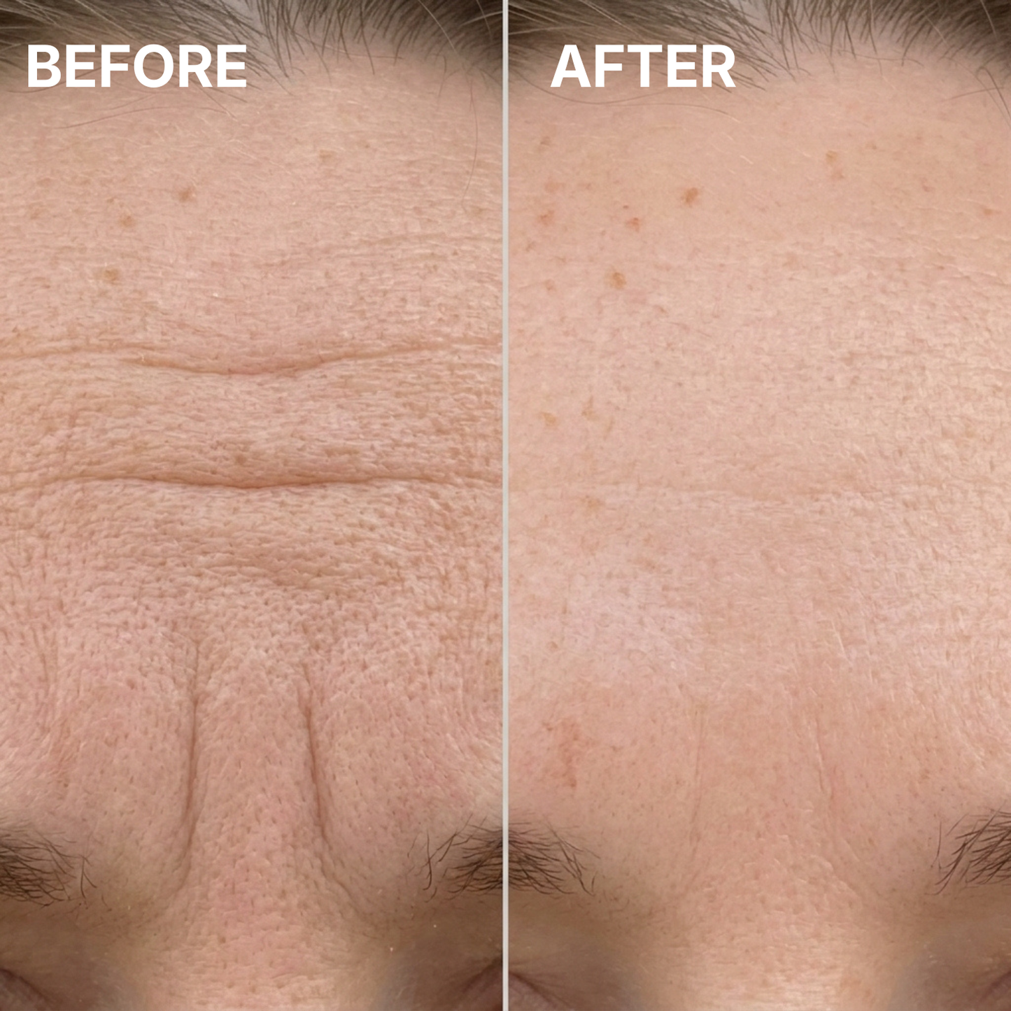 Raznave™ Collagen Volume Multi Balm
