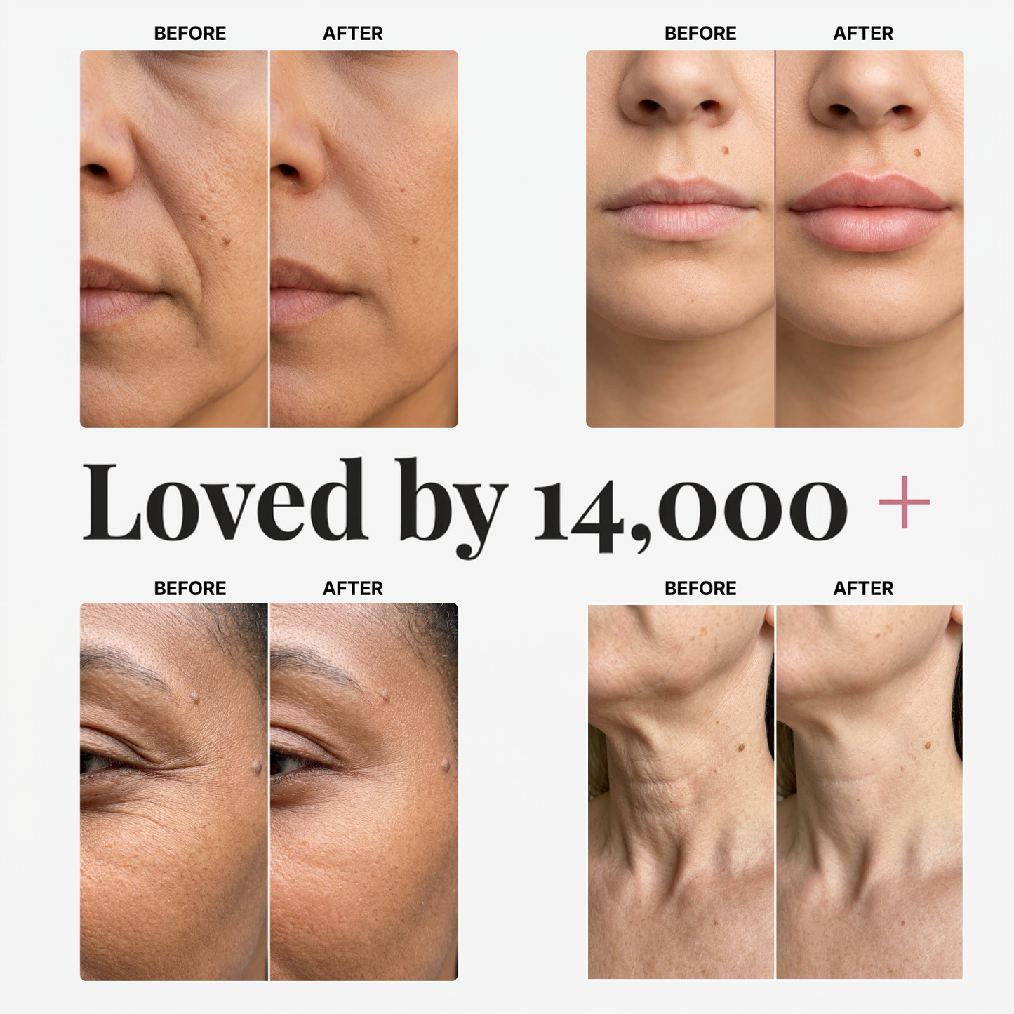 Raznave™ Collagen Volume Multi Balm